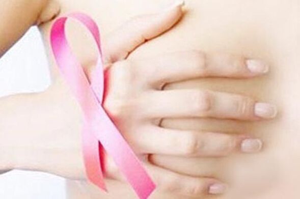 未经治疗的乳腺癌并不会自发消退