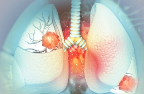 Ensartinib